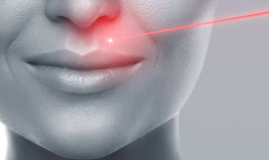 Ablacyjny laser frakcyjny — co dzieje się w skórze przy bliznach, porach i nierównej teksturze