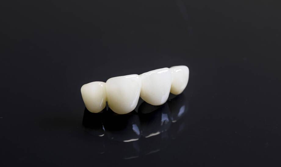 Kiedy korona porcelanowa ma sens i jak przebiega jej wykonanie
