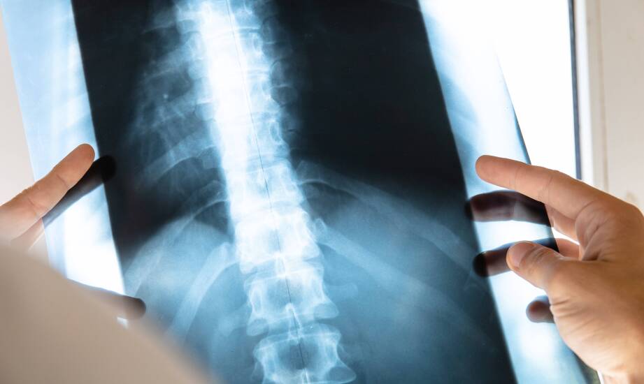Procesy kontroli jakości i zapewnienia spójności diagnostycznej w modelu zewnętrznej oceny obrazów rentgenowskich