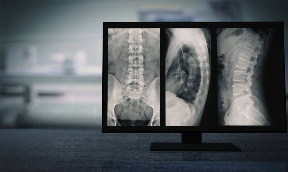 Wpływ precyzji zewnętrznego raportu rentgenowskiego na decyzje terapeutyczne w placówce