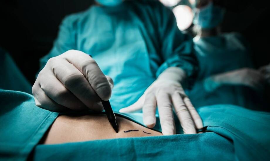 Liposukcja - co warto wiedzieć przed operacją odsysania tłuszczu?