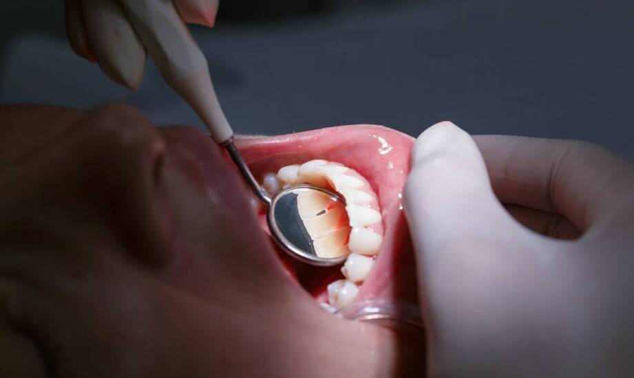 Leczenie endodontyczne – dlaczego jest niezbędne dla zdrowia zębów?