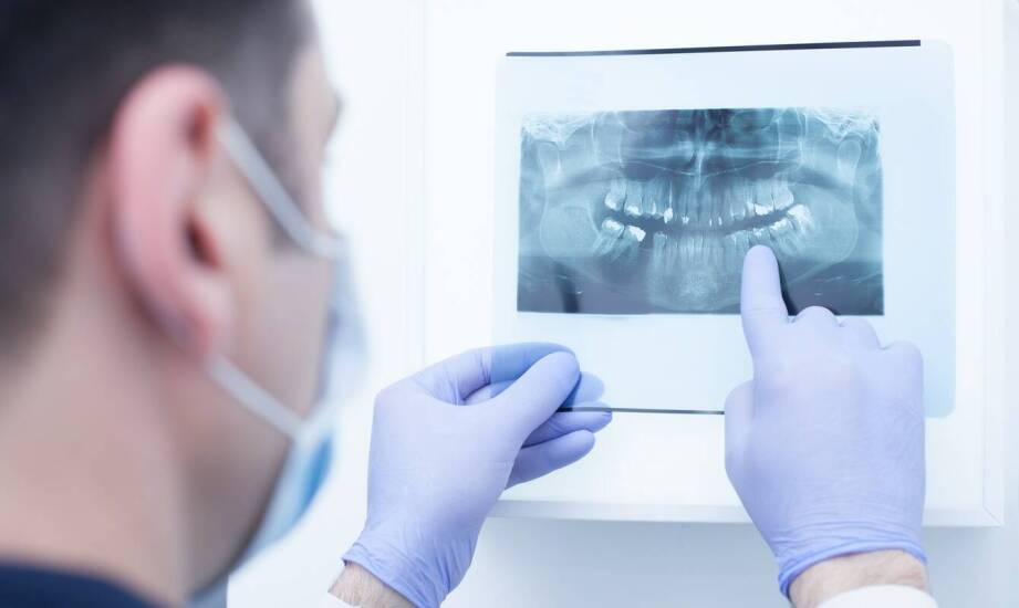 Wpływ tomografii komputerowej na wyznaczanie planu leczenia chirurgicznego w stomatologii