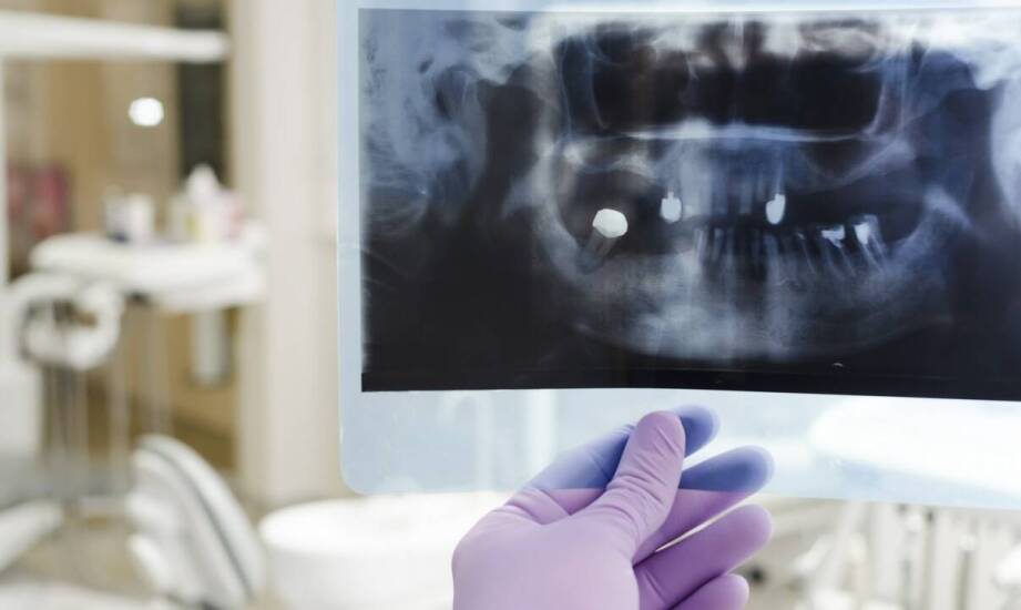 Rola diagnostyki RTG przed i po leczeniu endodontycznym