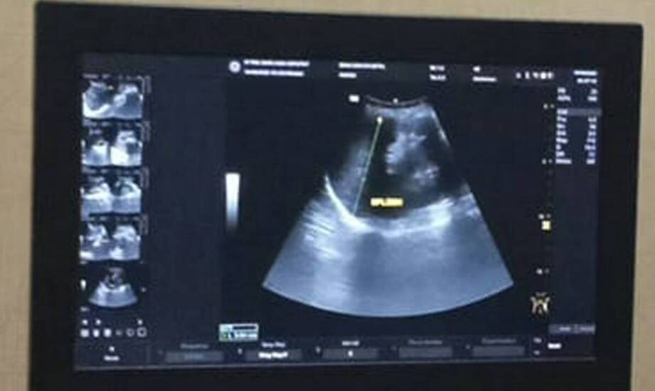 Zastosowanie ultrasonografii w diagnostyce chorób jąder