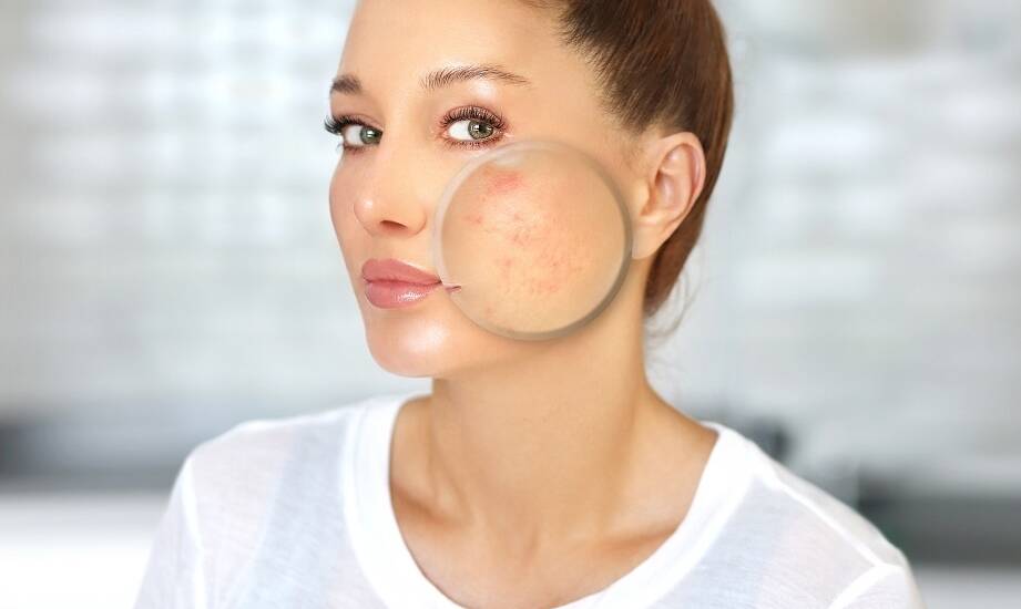 Dermatolog estetyczny a innowacyjne metody leczenia blizn