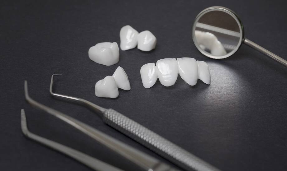 Estetyka zębów: Licówki porcelanowe jako sposób na piękny uśmiech