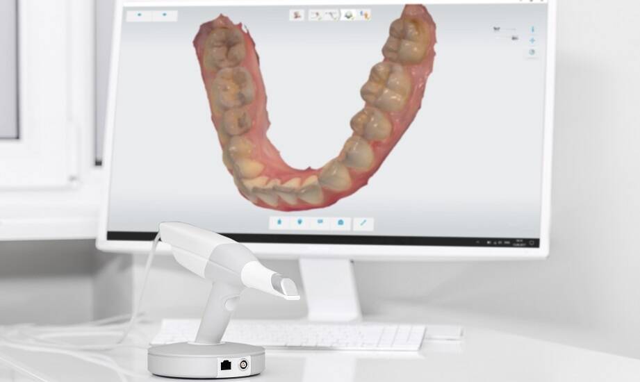 Zastosowanie skanera 3D w monitorowaniu postępów leczenia ortodontycznego