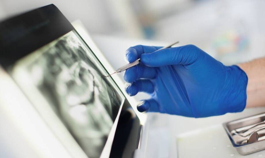 Znaczenie dokładności obrazowania RTG zębów w leczeniu endodontycznym