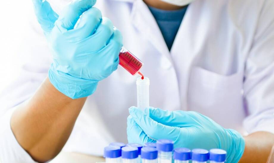 Czego można się spodziewać po wynikach testów toksykologicznych?