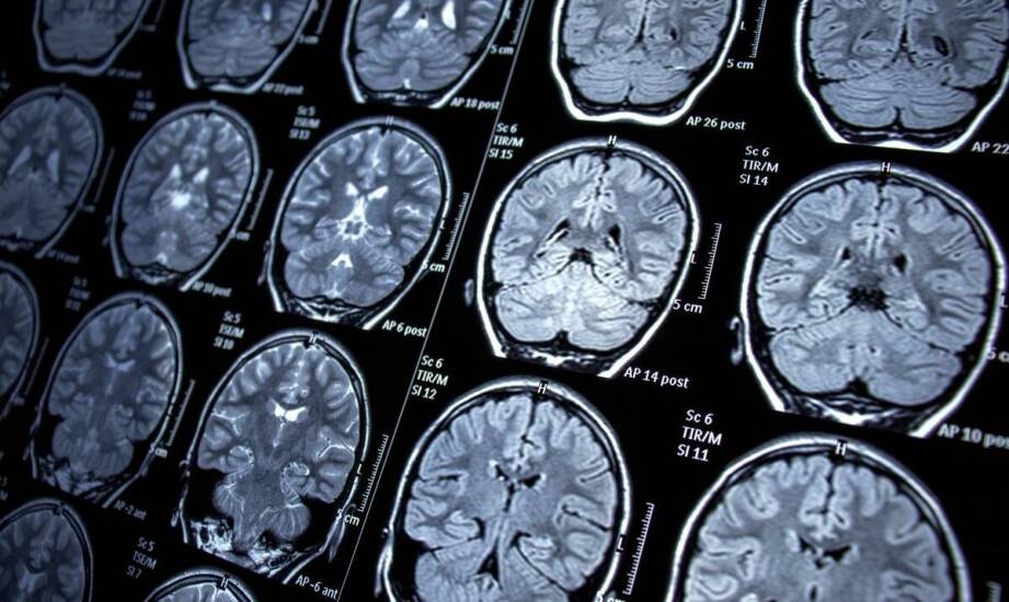 Jakie badania diagnostyczne przeprowadza neurolog w celu oceny zdrowia mózgu?