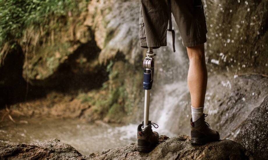 Zalety protezy hybrydowej w porównaniu do bionicznych rozwiązań