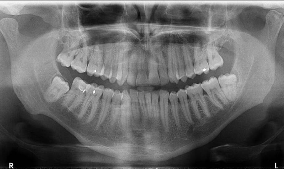 Jak radiowizjografia wspiera diagnostykę w stomatologii estetycznej?