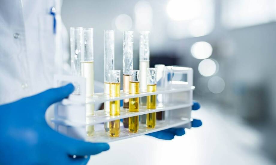 Wybór odpowiednich testów chemicznych do specyficznych badań laboratoryjnych