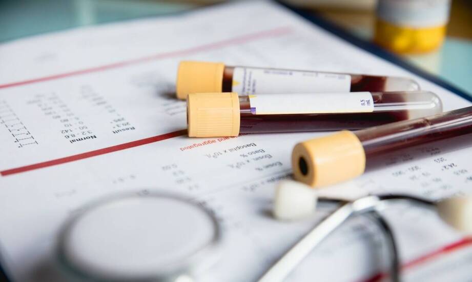 Czy badania genetyczne mogą pomóc w diagnozie problemów z włosami?