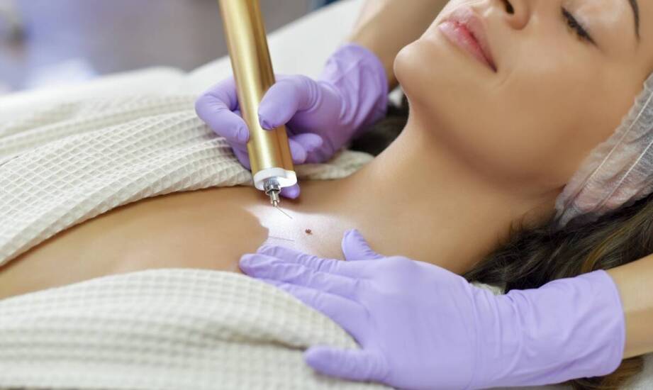 Jak skutecznie pozbyć się włókniaków?