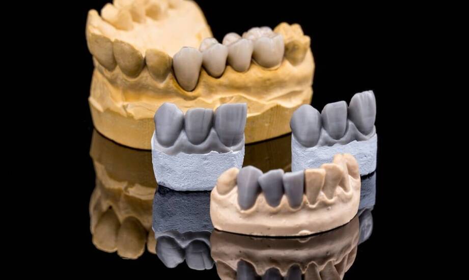 Jak wybrać wysokogatunkowy gips dentystyczny?