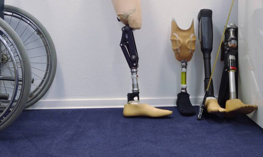 Innowacyjne technologie w tworzeniu protez podudzia – skaner 3D i drukarka 3D