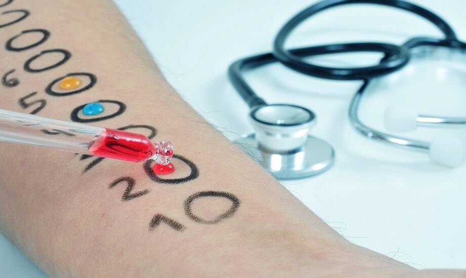 Istota precyzyjnej diagnostyki alergii dla lepszego zdrowia pacjentów