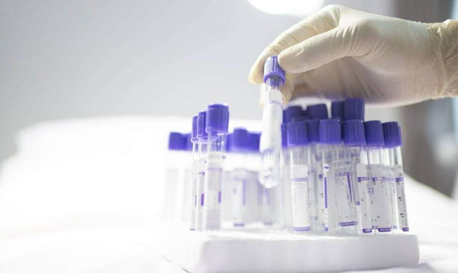 Jak analiza hormonalna wpływa na skuteczność terapii trychologicznej?