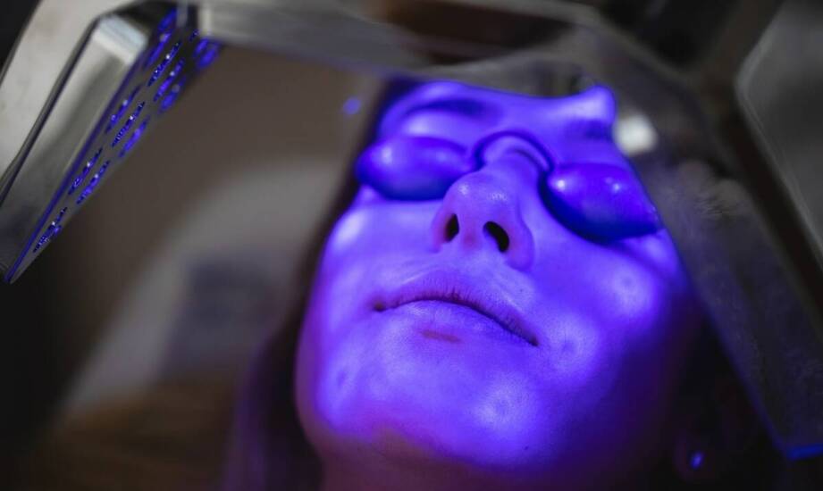 Długoterminowe korzyści z zastosowania laseroterapii w leczeniu trądziku