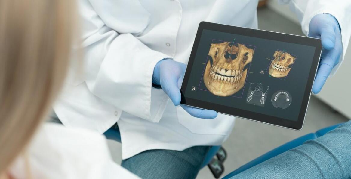 Jakie zalety niesie ze sobą diagnostyka z użyciem tomografii 3D w stomatologii?