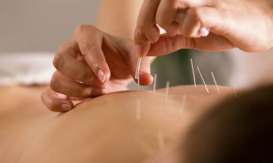 Czy akupunktura jest skuteczna na bóle kręgosłupa?