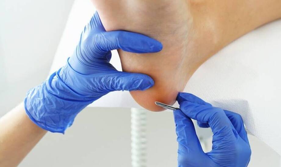 Skuteczność leczenia nadmiernej potliwości stóp w gabinecie podologicznym