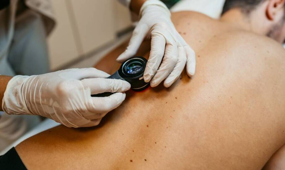 Kiedy warto sięgnąć po maść na świerzb bez recepty?