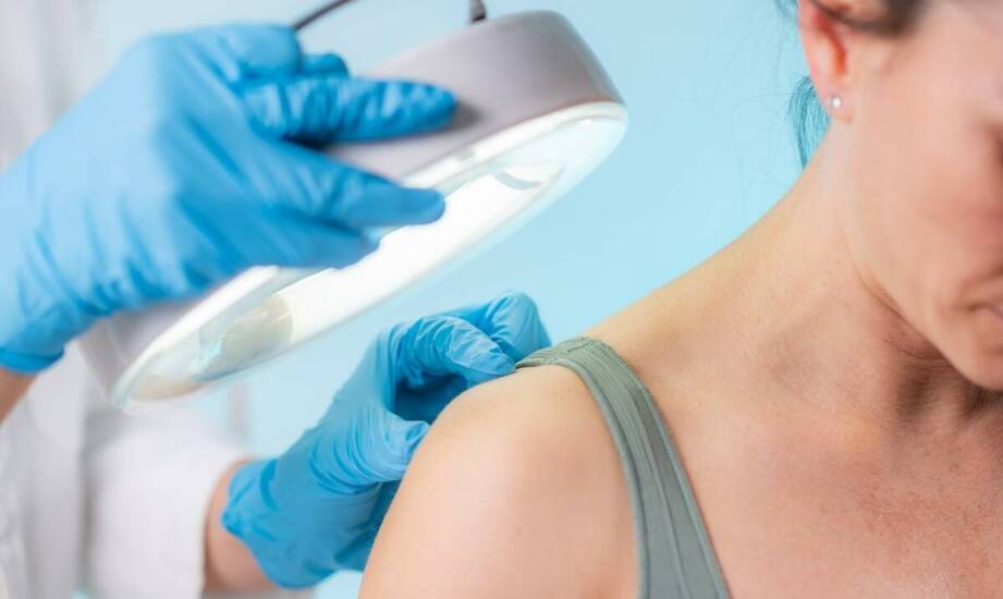 Jak ocenić znamiona skórne przed decyzją o ich usunięciu?