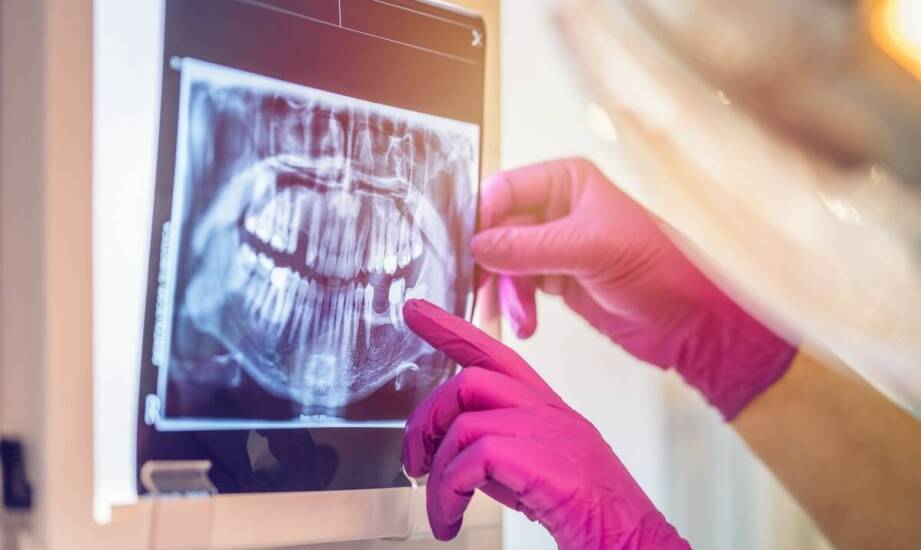 Jakie są kluczowe zastosowania pantomogramu w stomatologii?