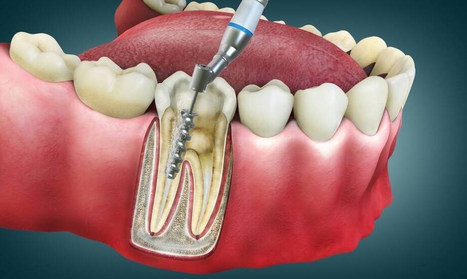 Jakie korzyści płyną z wykorzystania nowoczesnych technologii w endodoncji?