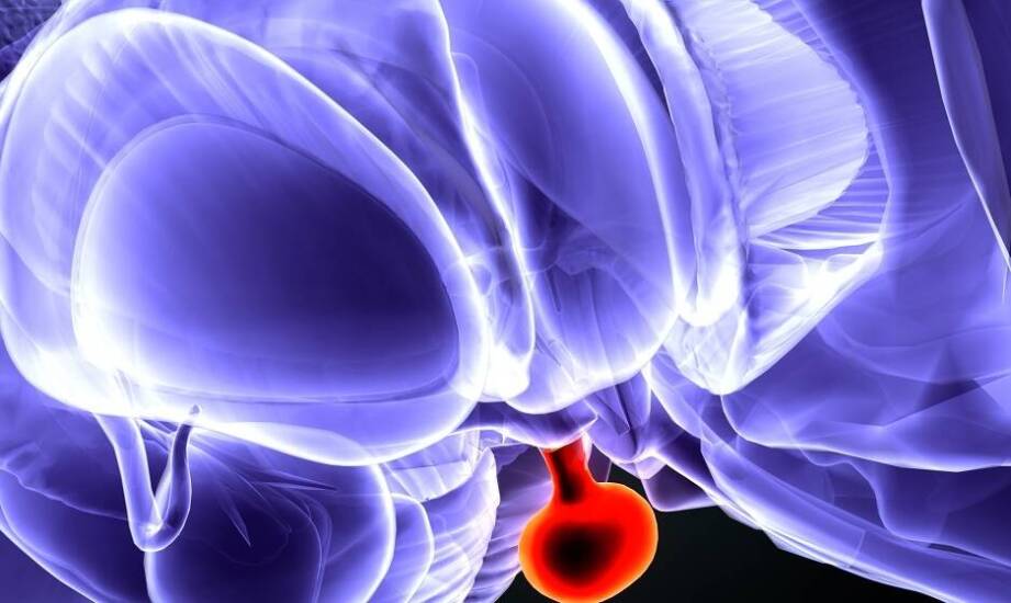 Znaczenie analizy lokalizacji i wielkości guzów przysadki