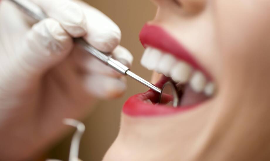 Jakie są wymagania dotyczące higieny jamy ustnej po założeniu licówek?