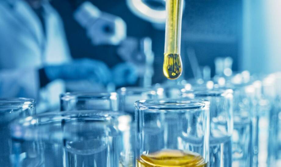 Jak analiza moczu wspiera diagnostykę chorób układu moczowego?