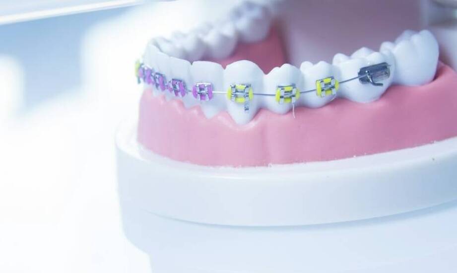 Jakie są korzyści płynące z leczenia ortodontycznego u dzieci?