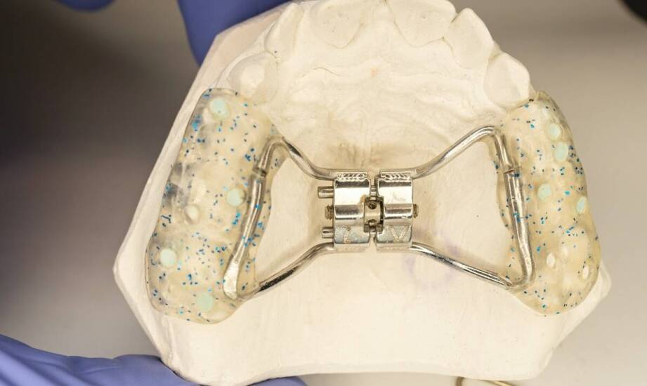 Jakie są etapy leczenia ortodontycznego dla dzieci i młodzieży?