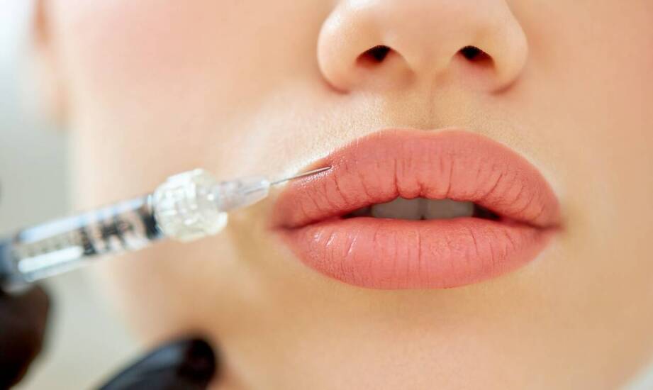 Wypełnianie kwasem hialuronowym: korzyści i efekty zabiegu