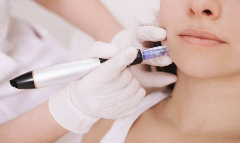 Dlaczego mezoterapia igłowa jest popularnym zabiegiem w medycynie estetycznej?