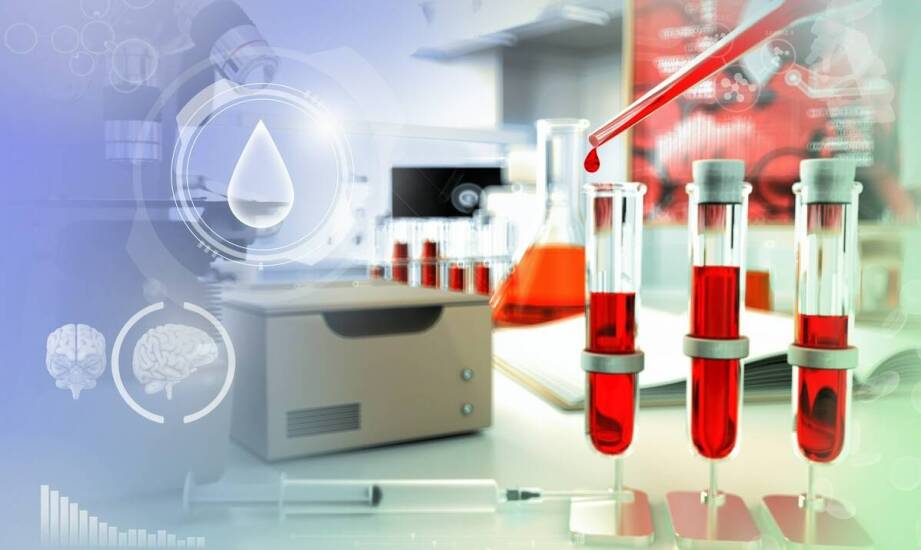 Wpływ nawodnienia na wyniki badań krwi: co musisz wiedzieć