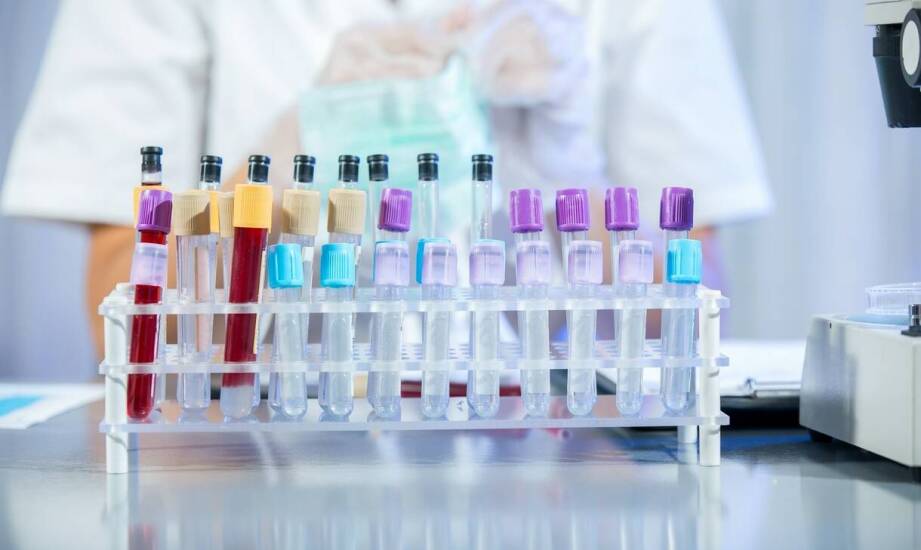 Jak dbałość o jakość paliw wpływa na wydajność silników?