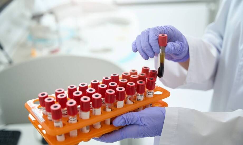 Zabiegi z osoczem bogatopłytkowym a choroby tarczycy: co warto wiedzieć?