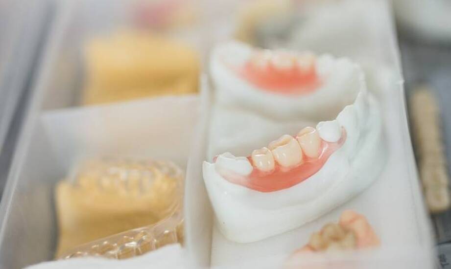 Wybór materiałów do implantów dentystycznych – co warto wiedzieć?