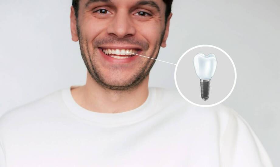 Jakie czynniki wpływają na koszt implantów?