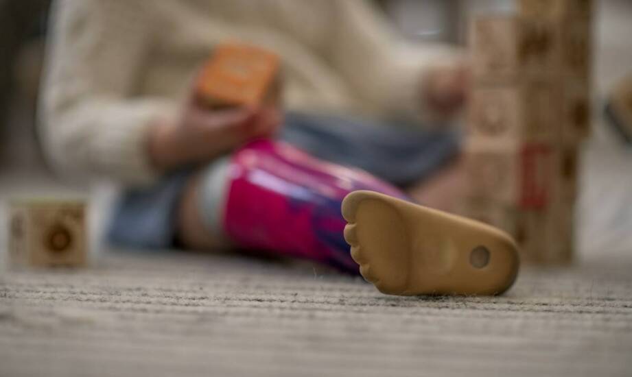 Wpływ skarpety silikonowej na ochronę kikuta i zdrowie skóry