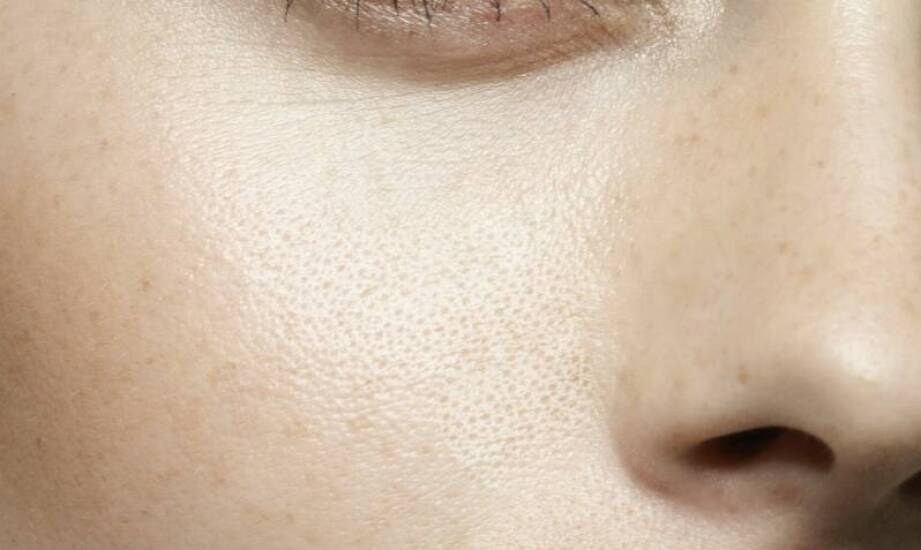 Mezoterapia igłowa – skuteczna metoda poprawy kondycji skóry