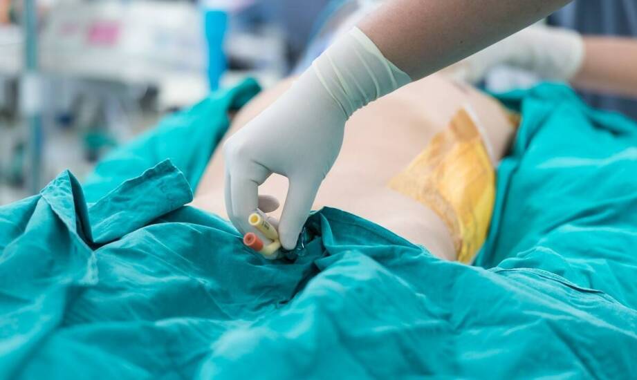 Balsamacja – znaczenie i zastosowanie w przygotowaniu ciała do pochówku