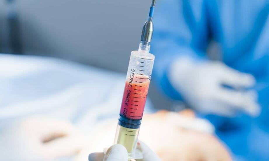 Lipo lab dawkowanie – co mówi o tym najnowsza medycyna estetyczna?