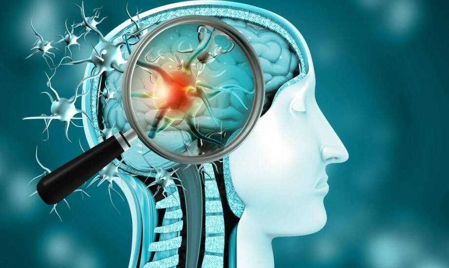 Najczęstsze schorzenia układu nerwowego – objawy, diagnoza, leczenie