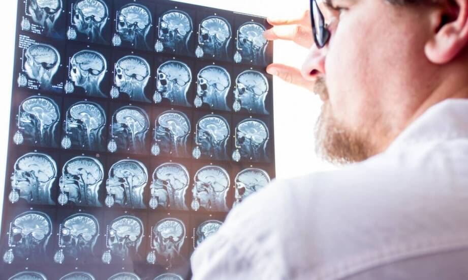 Najważniejsze objawy i czynniki ryzyka udaru mózgu – co warto wiedzieć